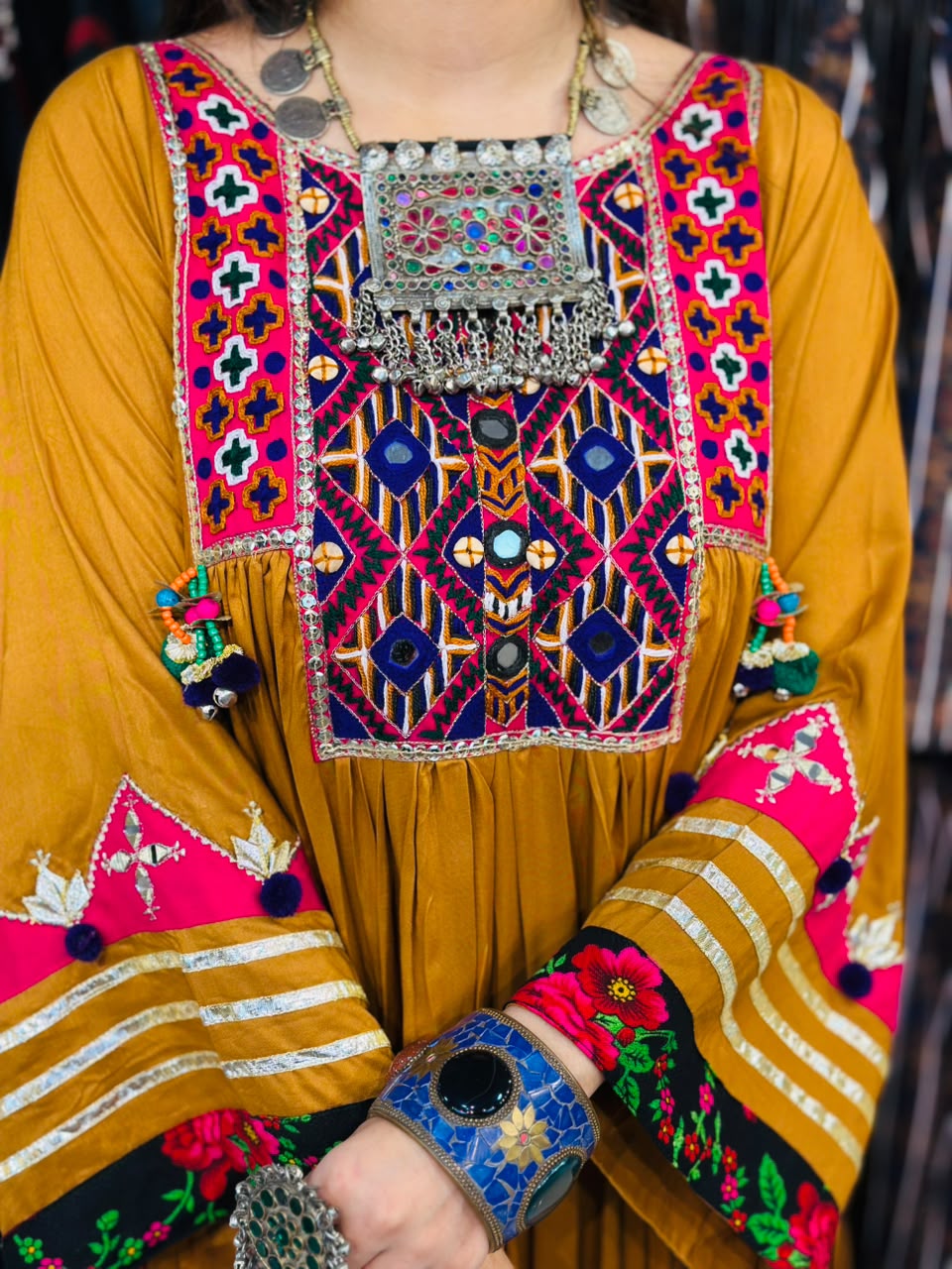 2 Pcs Mustard Muse - Featuring 100% Handmade Afghani Frock